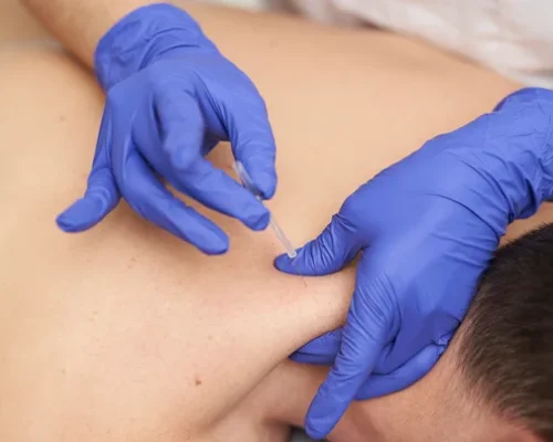 closeup_micro_needle_neck-1397565671