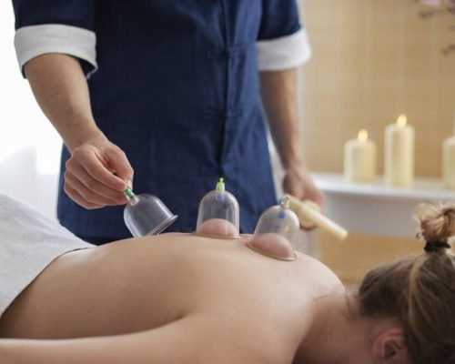 hand-putting-suction-cups-woman-s-back-1024x683